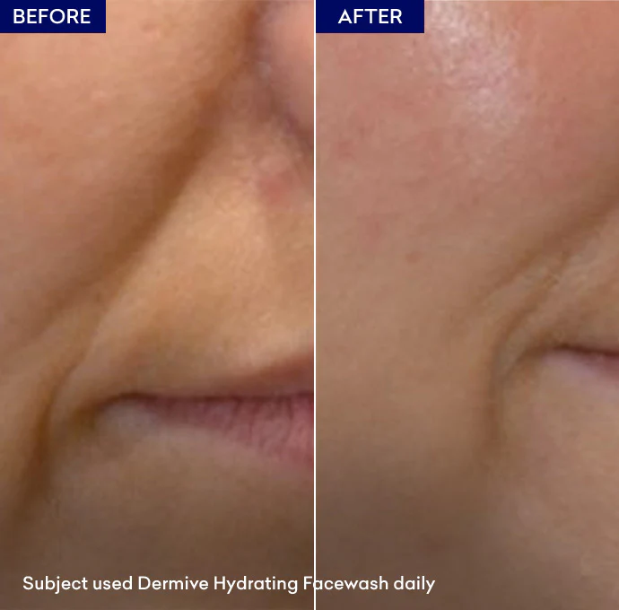 Dermive Moisturizing Wash - Image 5