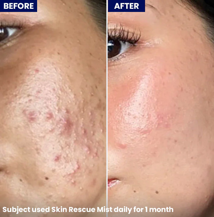 Skin Rescue Mist - Image 4